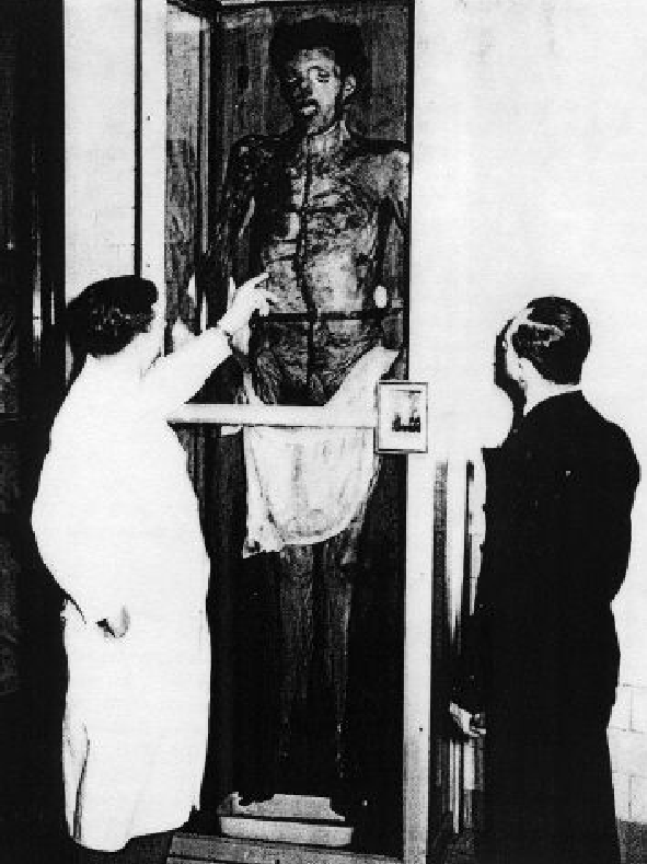 See the source image